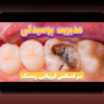 تحلیل ریسک ساده زندگی: راهنمای عملی برای ارزیابی و مدیریت ریسکهای روزمره